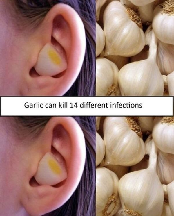 Garlic The Natural Infection Fighter
